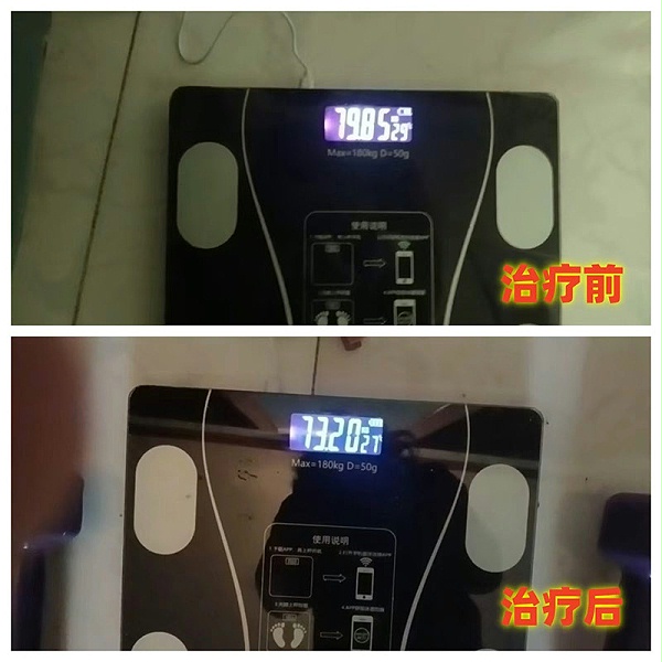 减重6.65公斤前后对比图