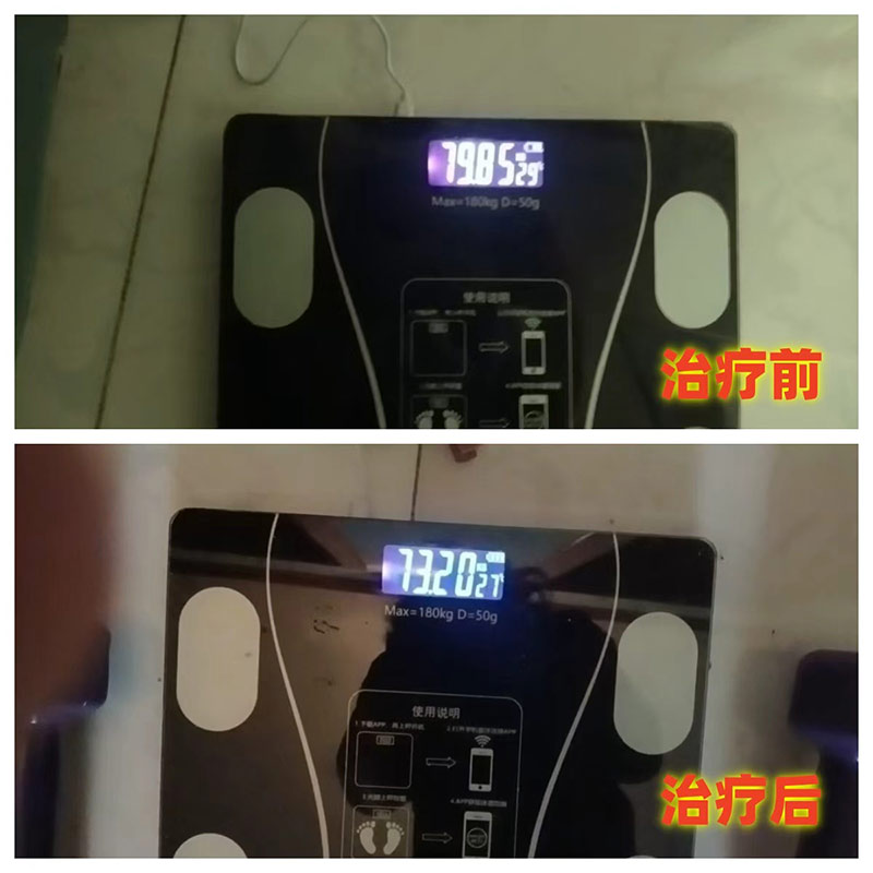 减重6.65公斤前后对比图