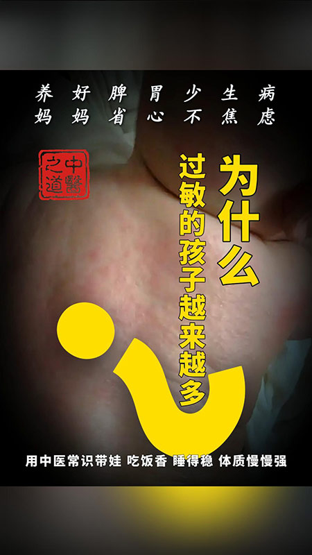为什么过敏的孩子越来越多
